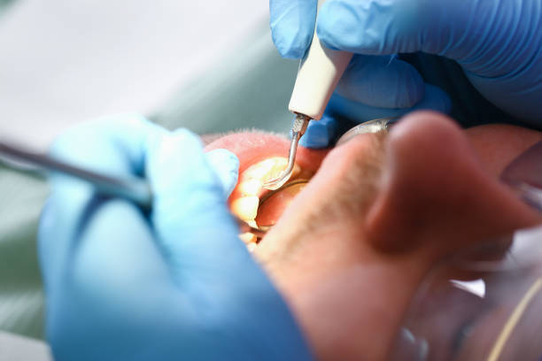 Best Mobile Emergency Dentist in Grass Valley, CA